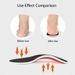 EVA Orthopedic Insoles Shoes Men Orthotic Flat Foot Arch for Plantar Fasciitis Inserts Feet Massage Shoe Pad_desvips.com